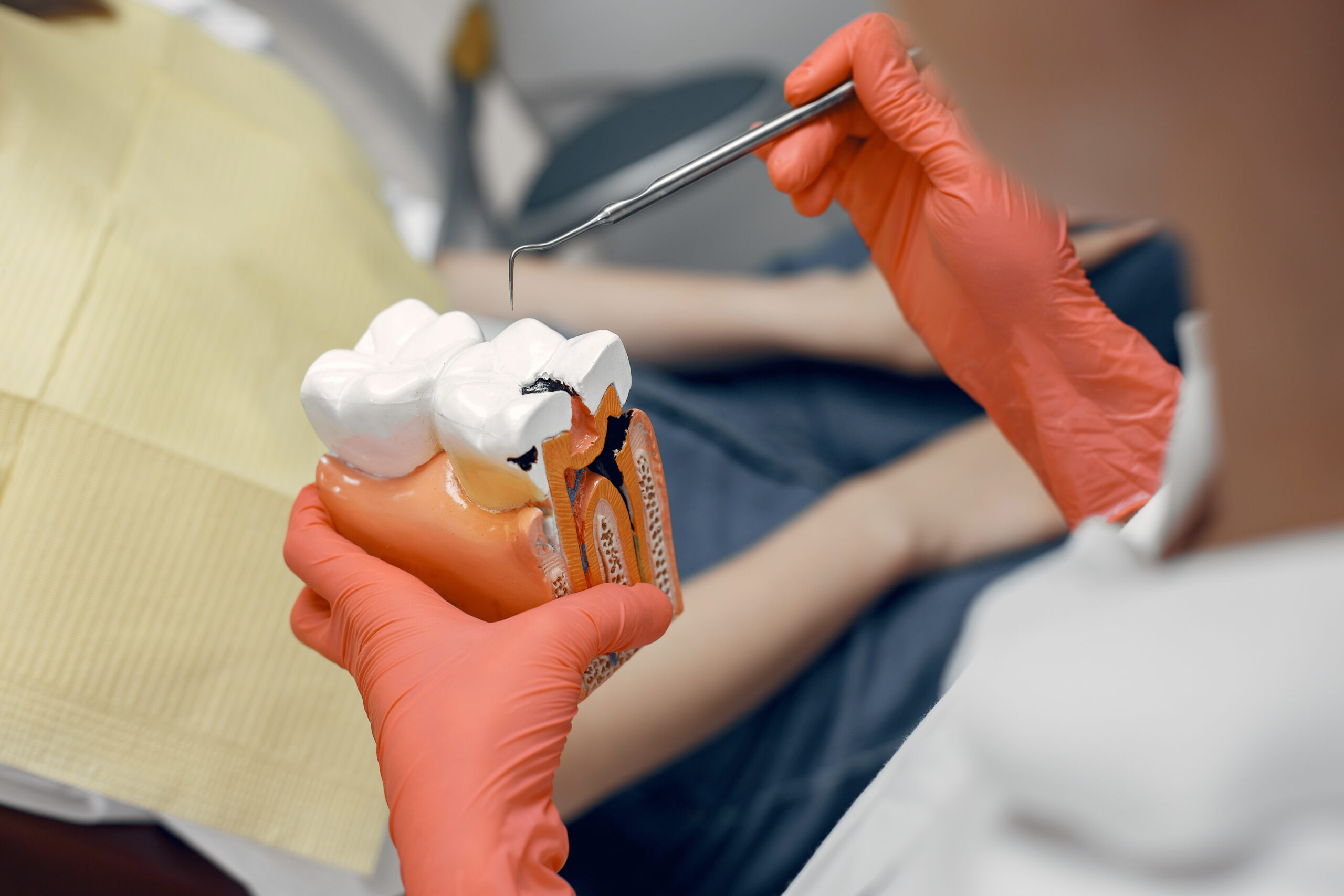 Dentist Shows Patient Root canals in Indianapolis 