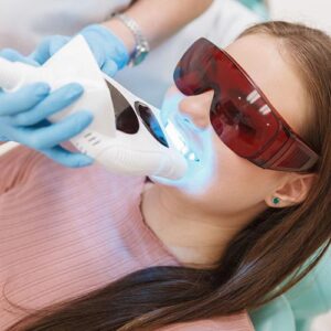 Teeth Whitening