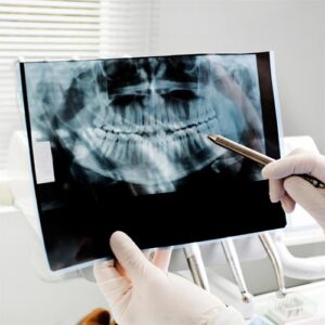dental x-ray