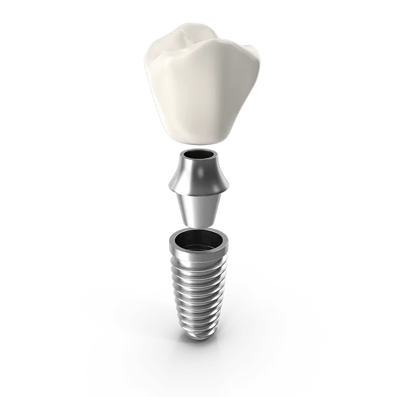 Diagram of a dental implant showing the crown, abutment and implant post